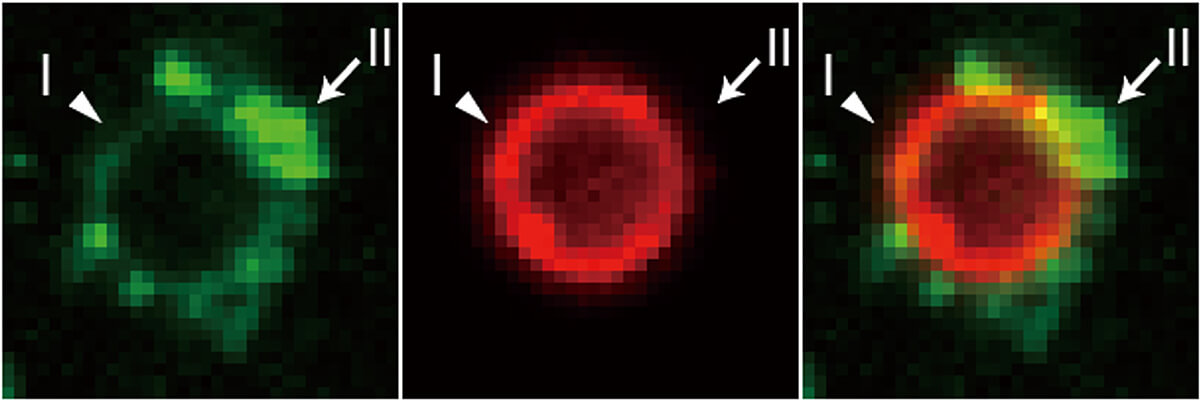 Membrane tethering via condensate Yun H et al., EMBO Rep(2023)